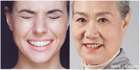 效果|抗皱没效果?皱纹形成的原因,你可能忽略了这些因素