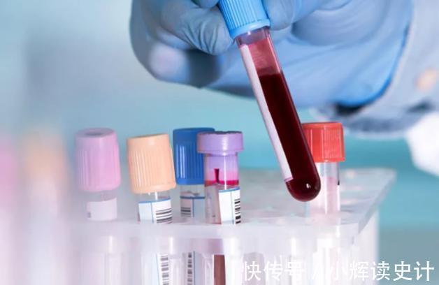 生存率|癌症多久不复发算治愈？若4项指标全正常，或离治愈不远了