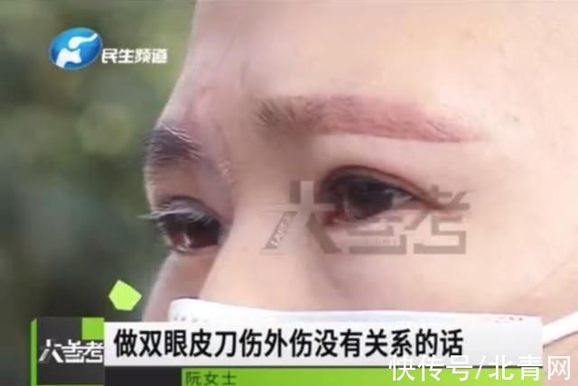 整形美容 女子割双眼皮后变“白眉大侠”？怀疑手术引起白癜风