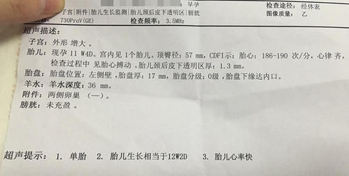 孕酮|确定怀孕后，第一次产检是在什么时候？超过这个时间，就晚了