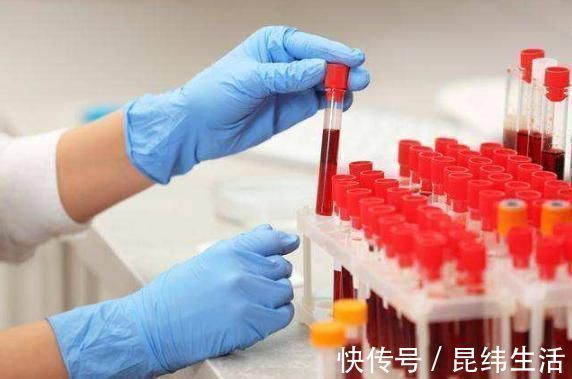 胆固醇|血脂高的人，头上会有5种“怪状”，学会3招，不怕脑梗找上门