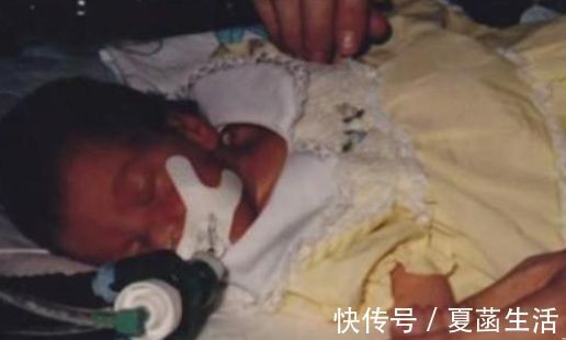 心脏|36年前，美国医生将狒狒的心脏移植给一名婴儿，成功救助后来如何