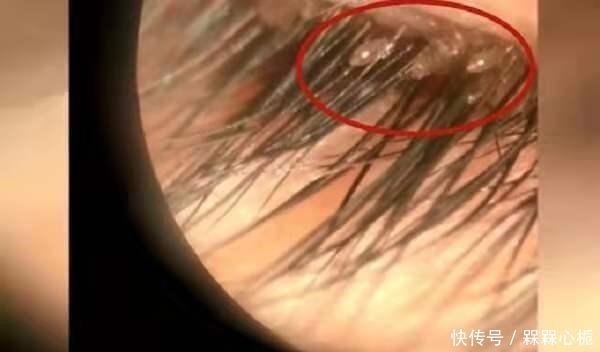 医院|女儿频繁揉眼睛,父母带去医院检查,惊出一身冷汗!网友真心大!