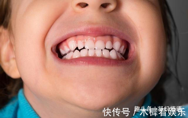 牙齿|几张图说明宝宝长牙的症状和顺序,你家宝宝掉队了吗快来对照吧