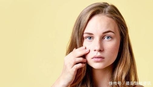 怎么去脸上的红血丝,去红血丝的方法有哪些