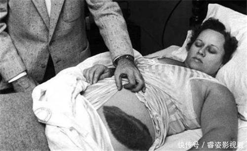 王正月 唯一被陨石砸中的人,虽只受了轻伤,但后续的麻烦却改变了她一生