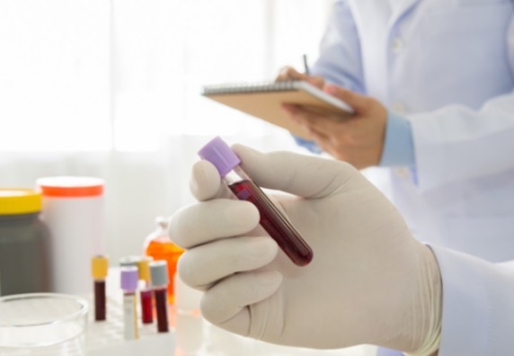 医生|肺癌一查就是晚期其实双腿早就给了信号,只是大多数人都忽视了