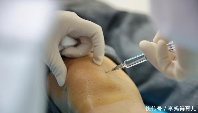 56岁女子，查出滑膜炎，医生惋惜：身体早有提示