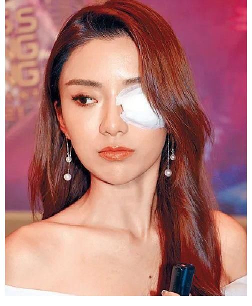 紗布|突然生眼挑針！3號候選佳麗以“獨眼龍”形象示人，擔心影響奪冠