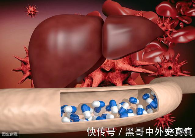 胆红素|肝功能正常，肝脏无病是误区，结果却显示肝癌？到底是怎么回事？