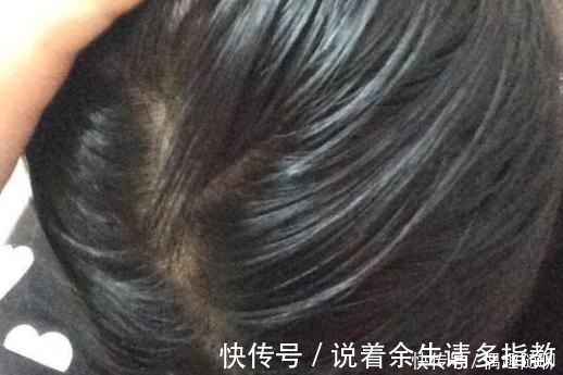 护发素|头发洗完隔天油?内行人:洗头时不仔细这4点,干性发质也易油!