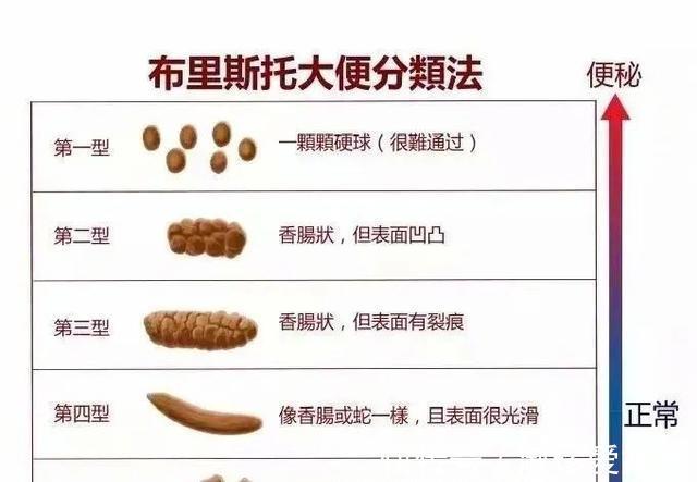 排便|实用拉粑粑常遇便秘困扰五个巧招或助你解决每日晨起大事