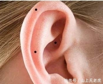 对照|如果你脸上这几个地方有痣,天生大富大贵对照看有没有你呢