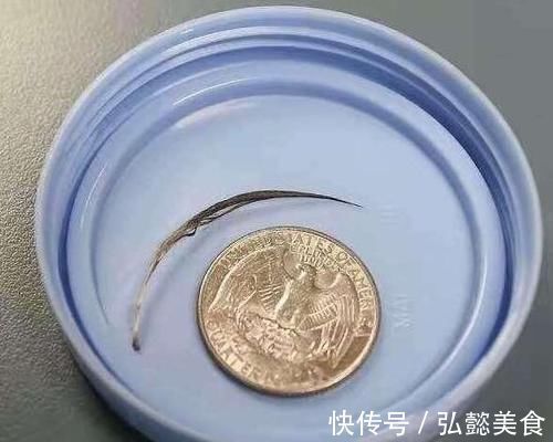 家里面|宝宝脖子长羽毛,家长当过敏治,医生说出原因家长吓出一身汗