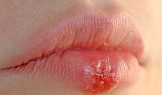  方说|艾滋病的临床表现有哪些？医生：此些不起眼的表现值得关注！