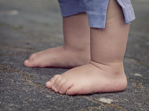 腿部|家长常做的3个陋习,很容易让娃腿部变形,别再上赶着去做了