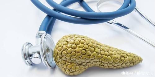 癌症|胰腺癌被称为癌症之王，眼睛皮肤出现一个症状，提示癌症已是晚期