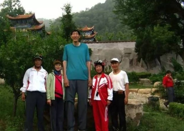 第一男|中国第一男巨人鲍喜顺:12年前不听医生建议生下儿子,如今怎样了