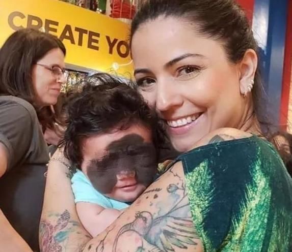 合照|宝妈生下“蝙蝠侠”胎记宝宝,发合照鼓励女儿,不料留言令她崩溃