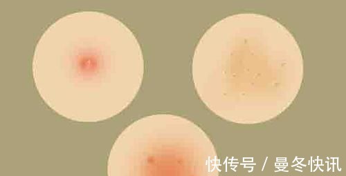 食物|女性不想老得快,常吃碱性食物,美容养颜,皮肤更水灵,50不显老