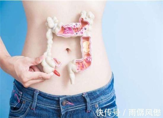 肠癌|“肠癌”初期不疼不痒，身体这“3处”会出现异常，可自测！