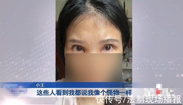 唐女士|“老公骂我是怪物，要跟我离婚!”重庆女子三次割双眼皮却越割越丑，整容变“毁容”?女子:想死的心都有了