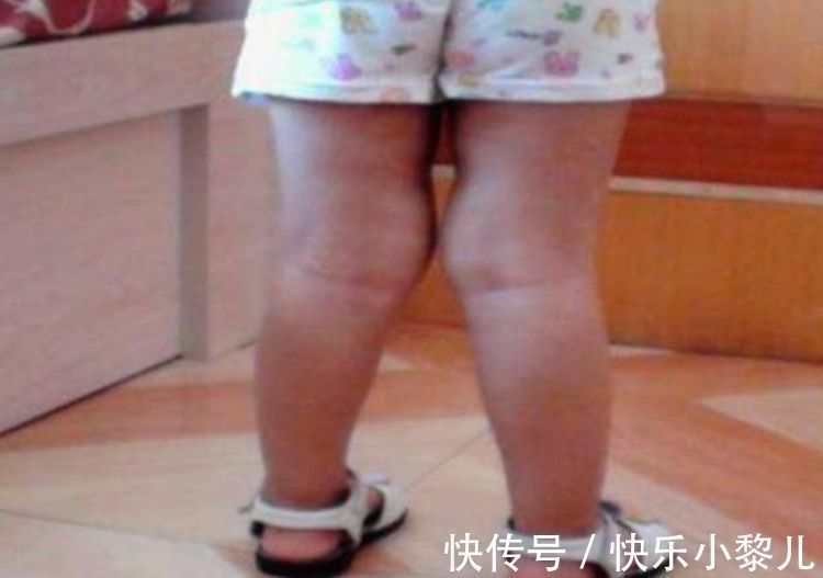 宝宝|别给新生儿穿两种衣服,会影响宝宝腿型发育,长大腿型差会怪你