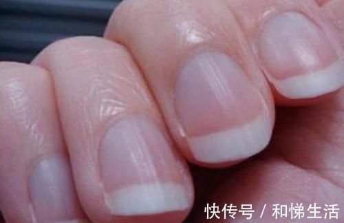 指甲|手上出现这9个表现,可能是体内疾病发出的求救信号,别不当回事!