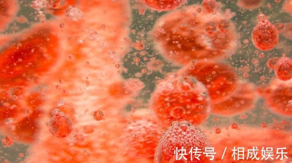 血脂|身体出现4种表现,建议赶紧去查血脂,早发现早治疗