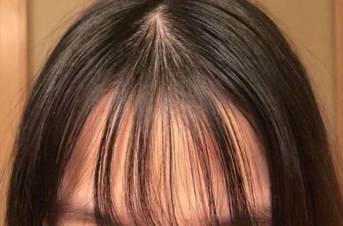 头发经常出油看上去很邋遢？女生做到这些，不用每天洗头也很清爽