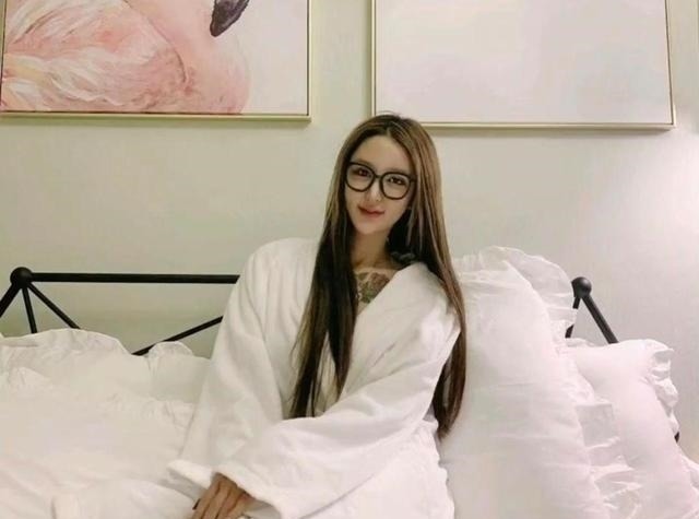 光额头 8年的整形手术花费了100多万,光额头就打了200多支玻尿酸