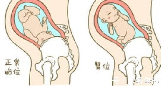怀孕|在怀孕之前，我们需要了解哪一些生殖常识呢？