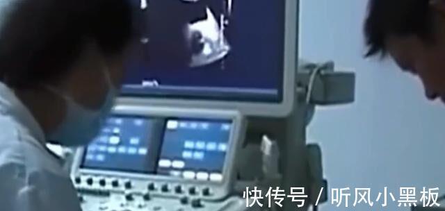 康梦茹|故事2岁女婴离奇“怀孕”,B超检查“已经成型”,冒险“生子”后怎样了?