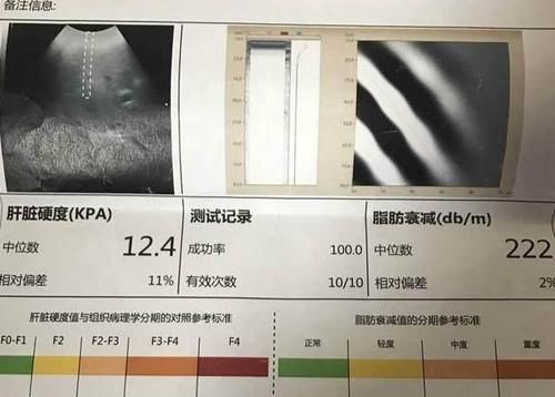 食用|肝不好就不能吃豆制品？提醒：2种食物多吃点，或利于养肝护肝