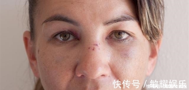 水谷精微|脾虚百病生脾有“三怕”,多吃“一果”,健脾祛湿一步到位