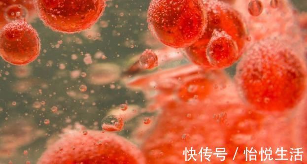 视力|降血脂的“冠军”找到了,搭配水一起喝,血管干净、血脂降下来了