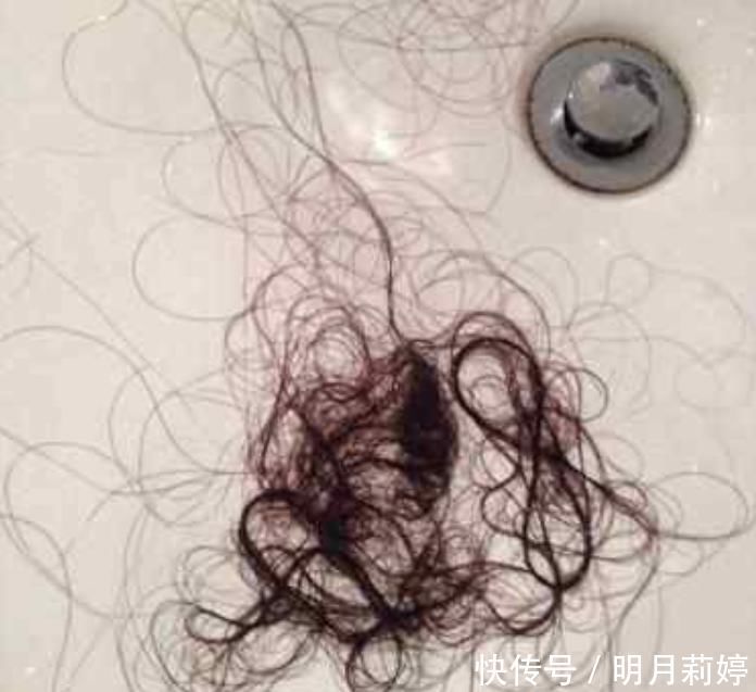 16岁女孩长期“不剪头发”,身体出现这变化,女生请务必了解!