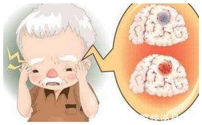 心脑血管|脑梗塞的发病病因被找到了!若能远离这个祸根,可能对身体好!