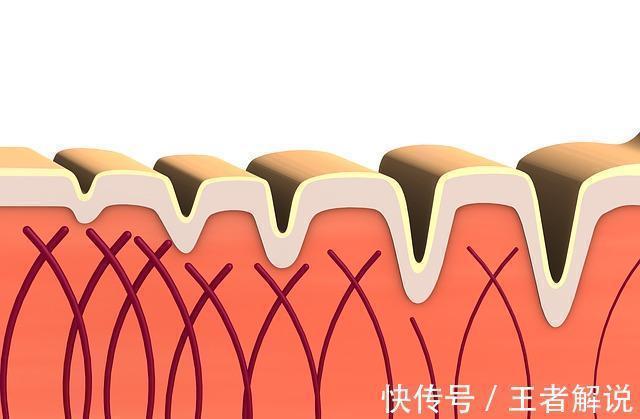黄褐斑 51岁女子从满脸斑到面部白净,分享:除护肤,3食物或是帮手