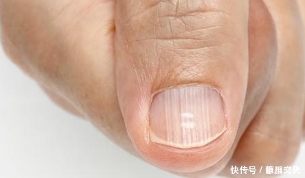 决明子|身体这4个表现说明“肝毒深”，3个养肝法，每天花2分钟护肝