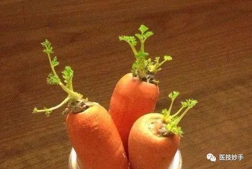 黄豆|发芽的蔬菜能不能吃?这4种蔬菜发芽后不仅没毒,反而营养更足