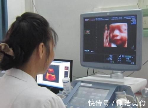 孕妈|孕妈看到胎宝“四维照”,表示娃不像自己,准爸爸:他也不像我!