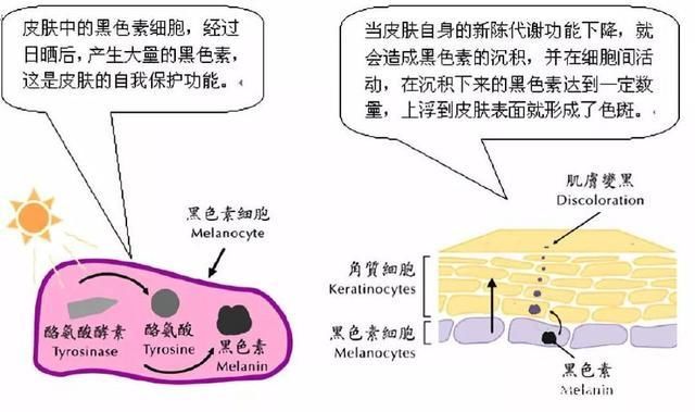 色素|广州伊站美容评价 美白小窍门不花冤枉钱