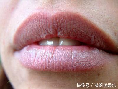 喝水|嘴唇总是干裂没亮泽不只是缺水,还跟缺乏一种营养素有关