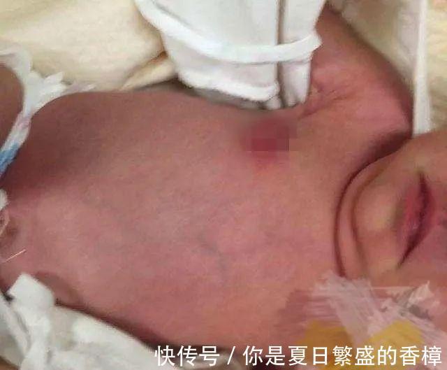 孩子|婆婆在宝宝身上动“手脚”,妈妈掀开衣服后大哭,网友迷信害人