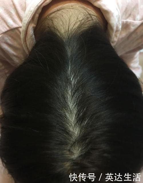 头发|女生晚上睡觉,到底是该扎着头发还是散着头发?