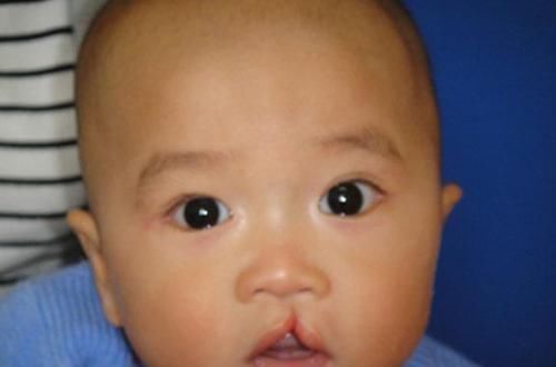 怀孕|产妇生出“兔唇儿”,谎称孕期吃了兔肉,被揭穿后婆婆很生气