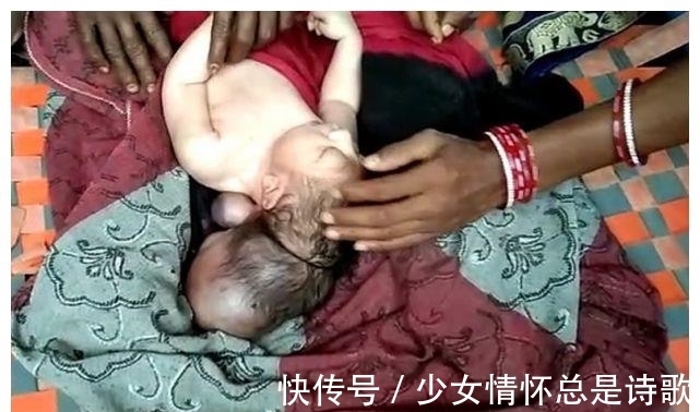 女子|印度女子产下“3头婴儿”，当地人认为是“上帝的化身”