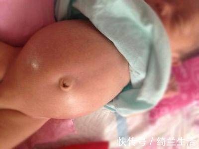 肚子|7个月的宝宝肚子总圆滚滚,还伴有肠鸣,医生的诊断让宝妈羞愧