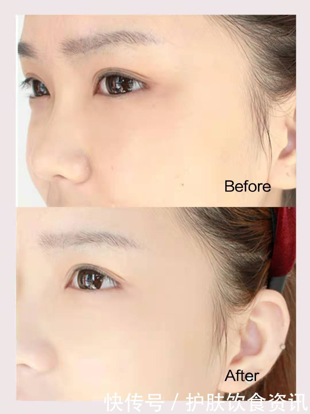 rmb|真实测评:这些年我吃过的胶原蛋白产品